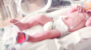 premature baby