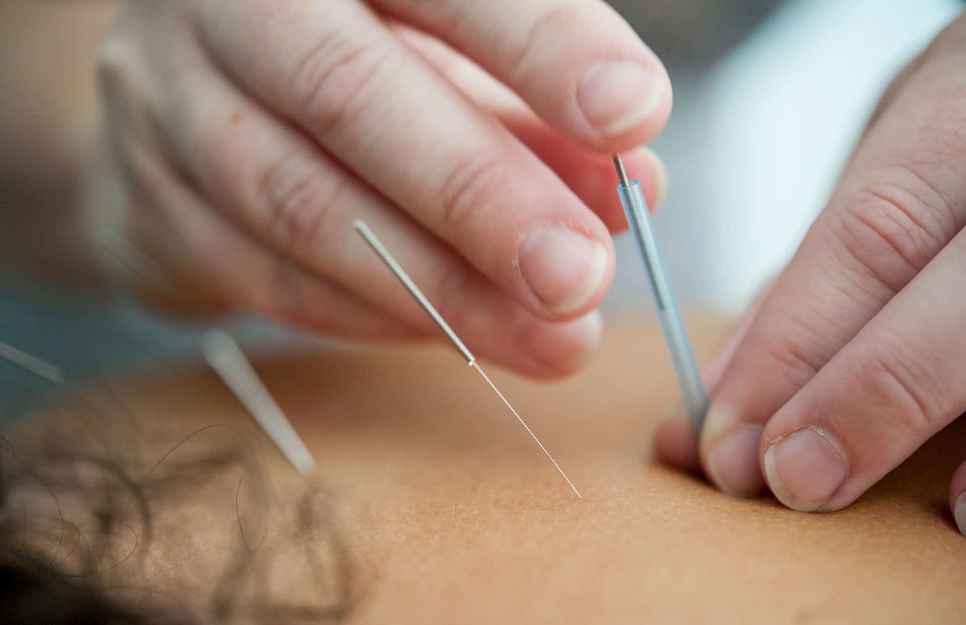 acupunctuur bij kinderwens fertiliteit zwangerschap (foto: Katherine Hanlon via Unsplash)